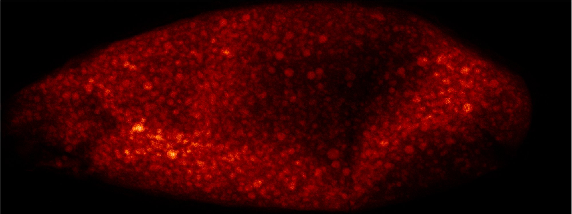 X-ray fluorescence microscopy image showing the distribution of an element in fruit fly oocyte